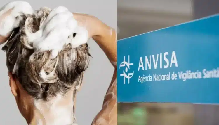 Anvisa